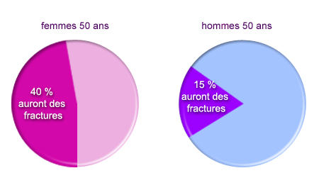 pourcentage ostéoporose à partir de 50 ns