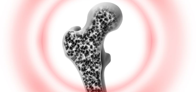 Ostéoporose et surdosages